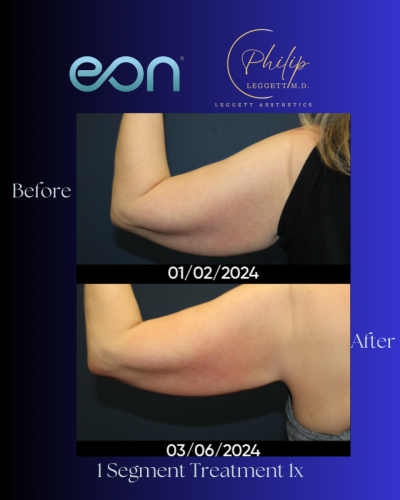 Copy of Frames (Instagram Post (45)) (1)