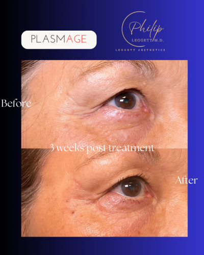 Copy of Frames (Instagram Post (45)) (1)_1