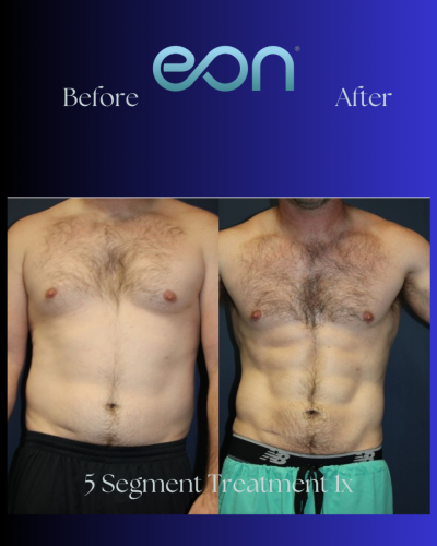 Copy of Frames (Instagram Post (45)) (2)