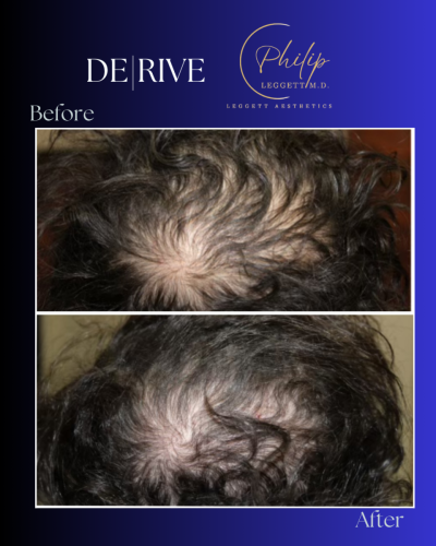 Copy of Frames (Instagram Post (45))