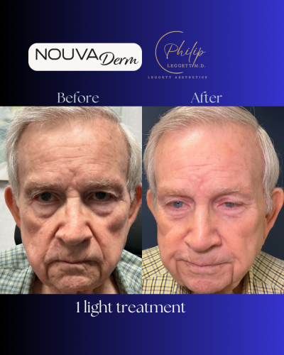 Nouvaderm Frame (1) copy